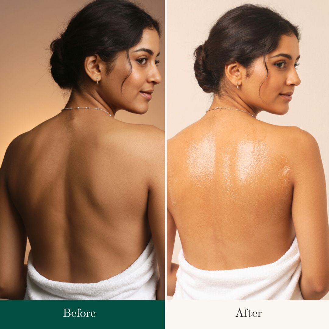 Before After 10